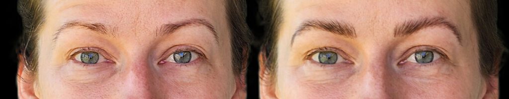 Before and after brow lamination using Lami Super Booster kit for use-at-home